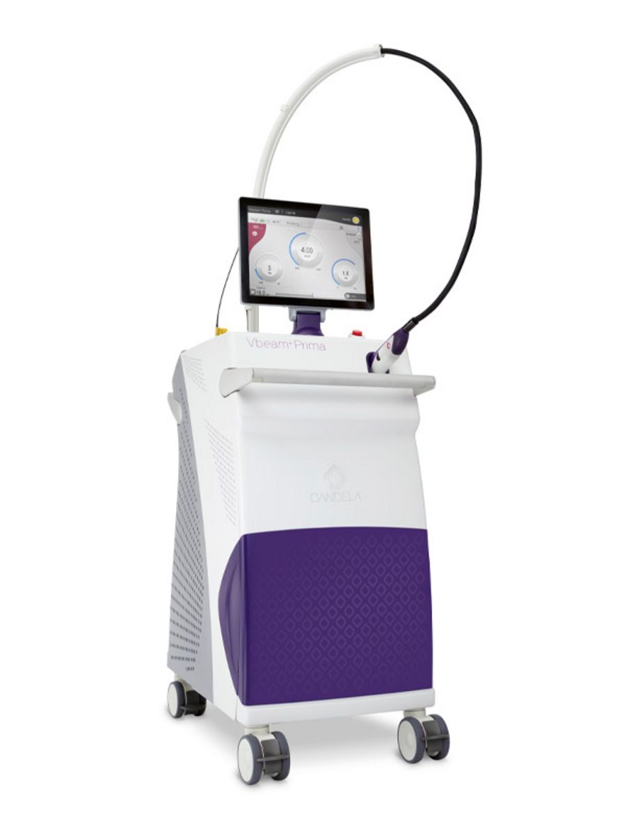 Candela Laser Vbeam Prima Candela Laser Vbeam Prima